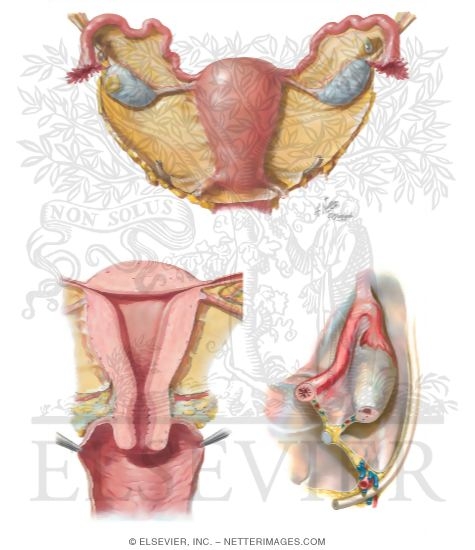 Uterus and Adnexa