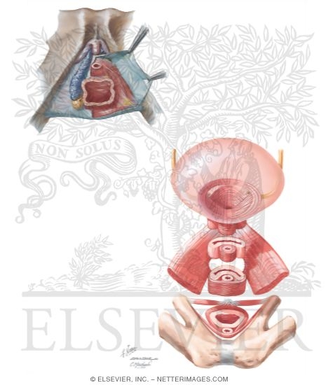 Watermarked preview of unlabeled image: Female Perineum and Urethrovaginalis Sphincter Complex