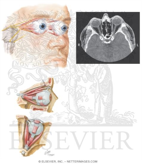 Watermarked preview of unlabeled image: Orbital Muscles
