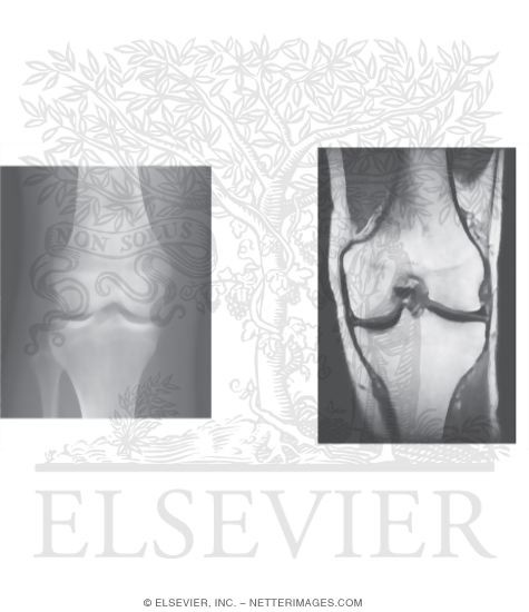 Radiographs of the Knee