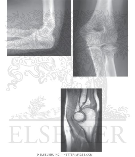 Watermarked preview of unlabeled image: Imaging of the Elbow