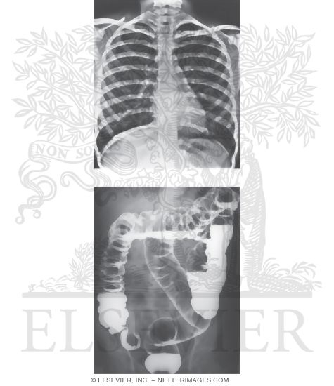 Plain (Conventional) Radiographs
