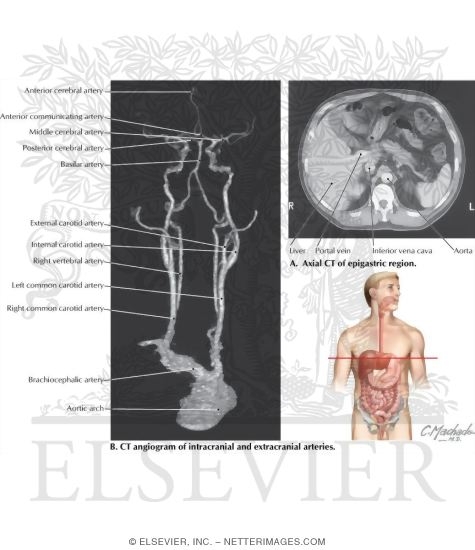 Watermarked preview of labeled image: Gastrointestinal System: Organization