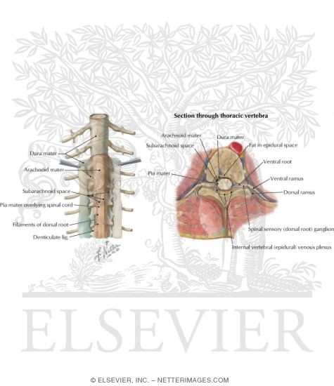 Watermarked preview of labeled image: The Spinal Meninges and Their Relationship to the Spinal Cord