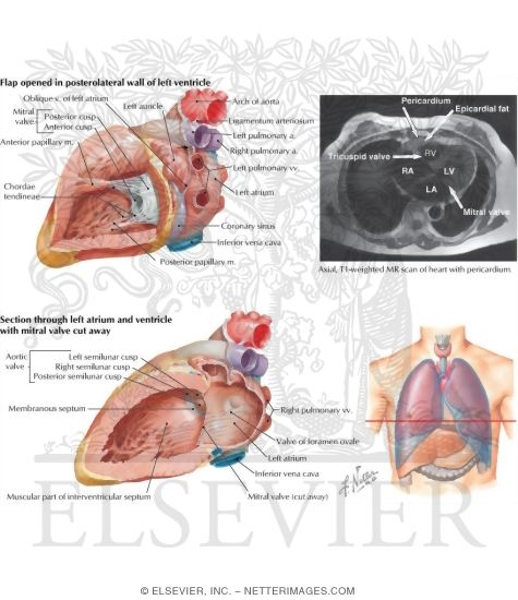 Left Atrium and Ventricle 