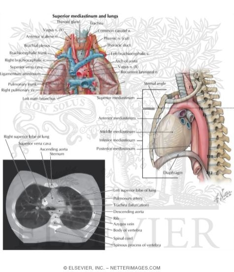 Watermarked preview of labeled image: Mediastinum