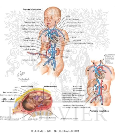 Watermarked preview of labeled image: Fetal Circulation Pattern and Changes at Birth
