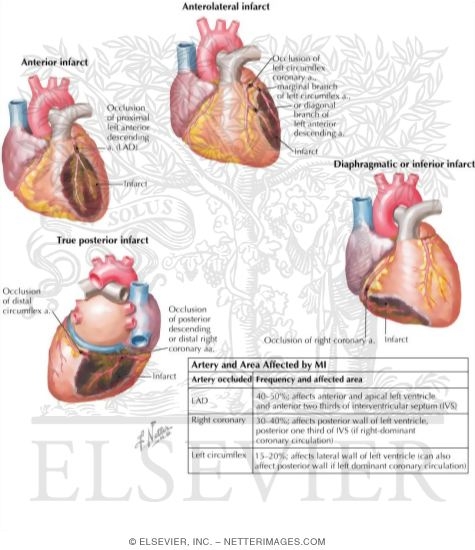 Watermarked preview of labeled image: Localization of Myocardial Infarcts