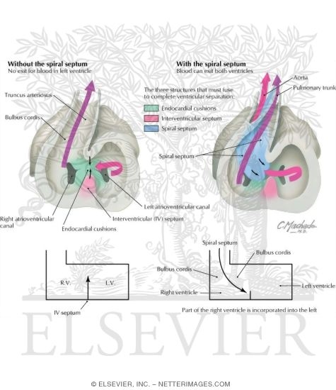 Watermarked preview of labeled image: Ventricular Separation and Bulbus Cordis