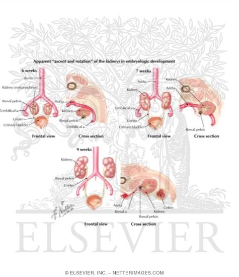 Ascent and Rotation of the Metanephric Kidneys