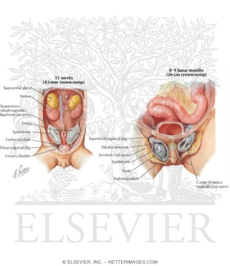 Watermarked preview of labeled image: Fetal Descent of the Testis