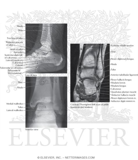 Watermarked preview of labeled image: Radiographs of the Ankle