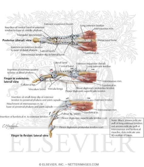 Watermarked preview of labeled image: Flexor and Extensor Tendons in Fingers