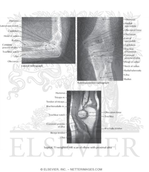 Watermarked preview of labeled image: Imaging of the Elbow