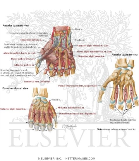 Watermarked preview of labeled image: Intrinsic Muscles of Hand