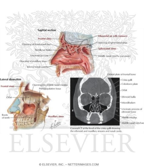 Paranasal Sinuses Paranasal Sinuses