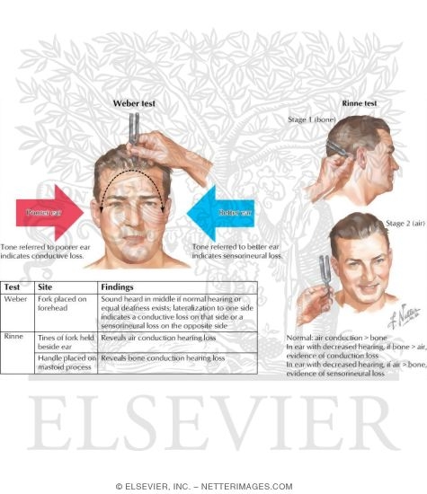 Auditory Nerve Testing Weber And Rinne Testing