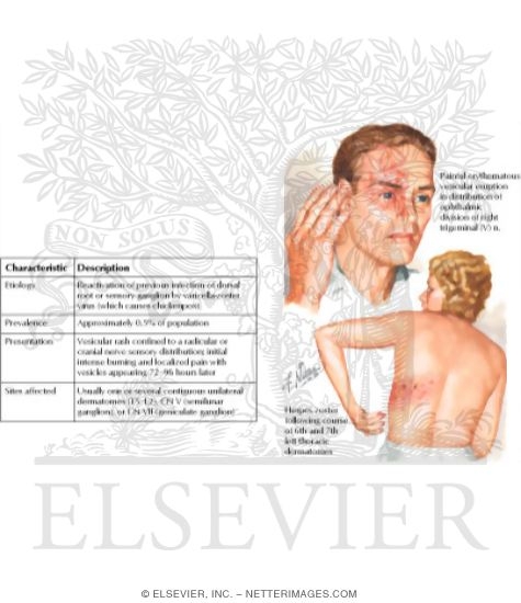 Watermarked preview of labeled image: Herpes Zoster