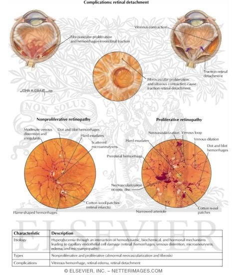 Watermarked preview of labeled image: Diabetic Retinopathy