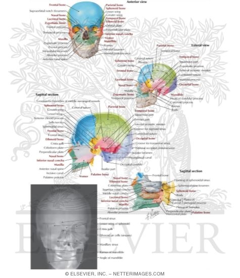 Watermarked preview of labeled image: Skull