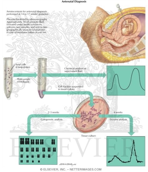 Watermarked preview of labeled image: Birth Defects: Antenatal Diagnosis
