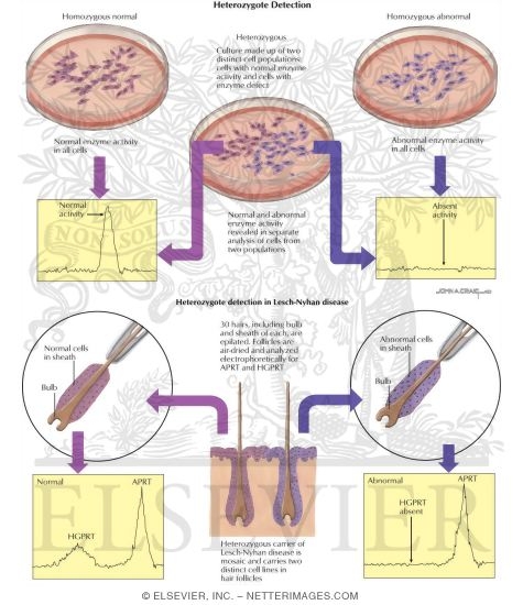 Watermarked preview of labeled image: Birth Defects: Heterozygote Detections