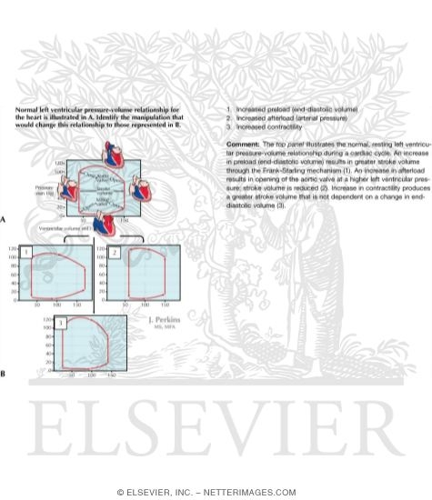 Watermarked preview of labeled image: Pressure-Volume Loop