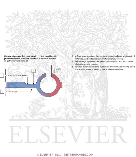 Pulmonary Vascular Resistance