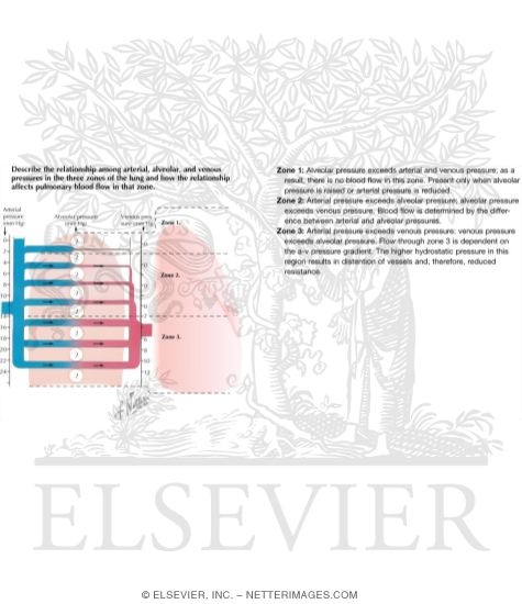 Watermarked preview of labeled image: Distribution of Pulmonary Blood Flow