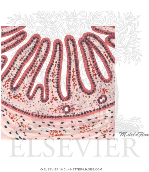 Eosinophilic Gastroenteritis
