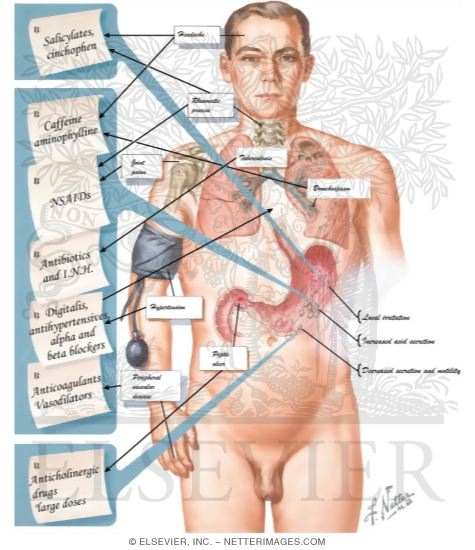 Watermarked preview of labeled image: Effects of Drugs On Gastric Function
Drug Side Effects