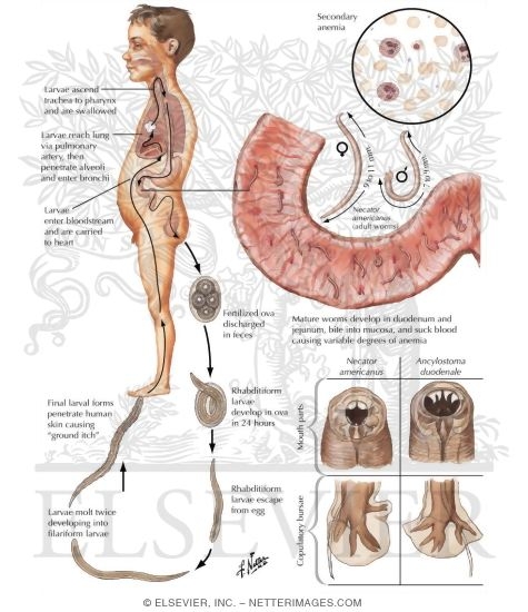 Parasitic Diseases V - Necatoriasis and Ancylostomiasis