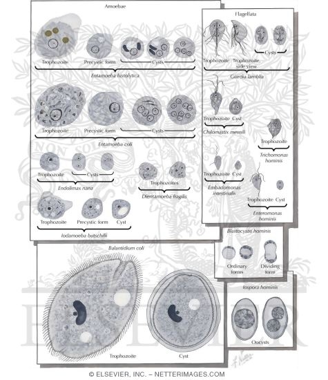 Watermarked preview of labeled image: Helminths and Protozoa Infesting the Human Intestine