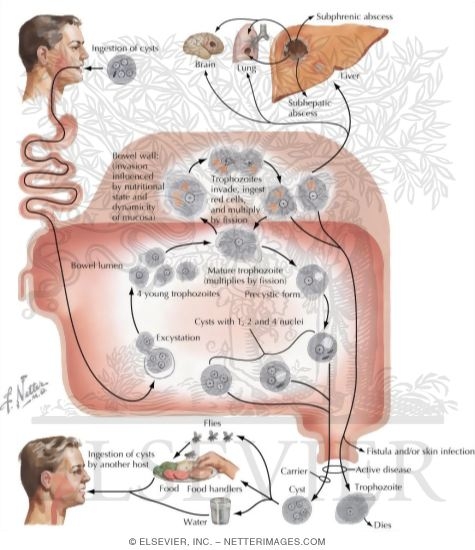 Watermarked preview of labeled image: Amebiasis