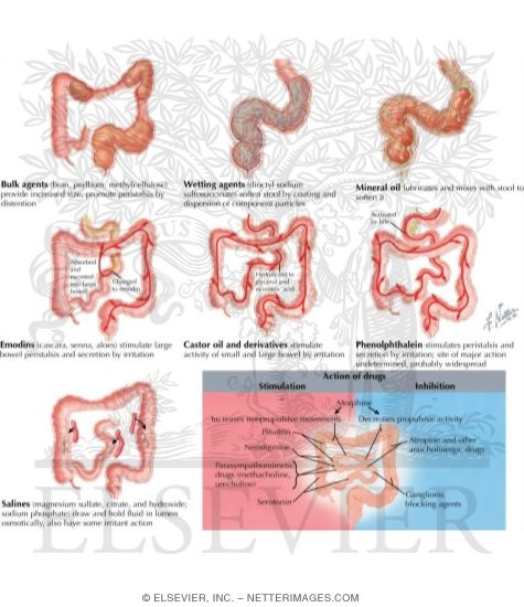 Watermarked preview of labeled image: Effects of Drugs On the Intestine