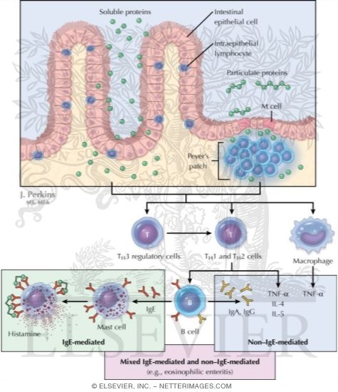 Watermarked preview of unlabeled image: Intestinal Disturbances Resulting From Food Allergy