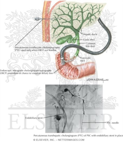 Imaging Studies of the Liver: Cholangiography