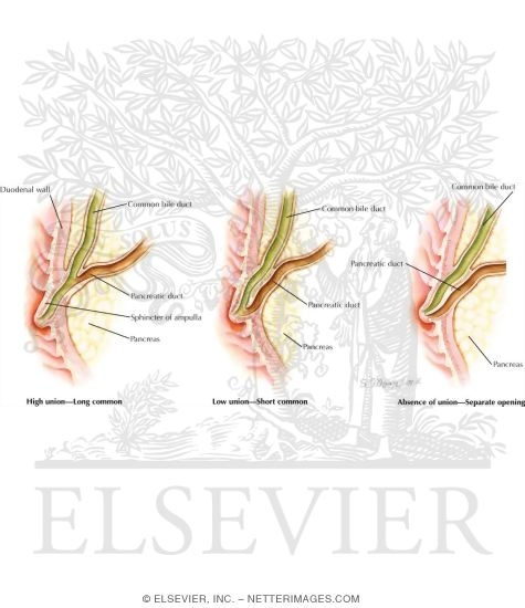 Sphincter of Oddi Dysfunction