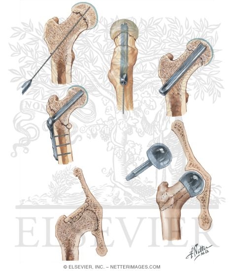 Watermarked preview of unlabeled image: Disorders of Hip