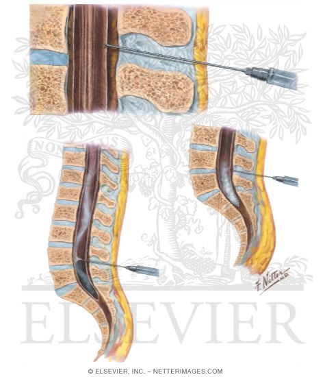 Watermarked preview of unlabeled image: Control of Pain