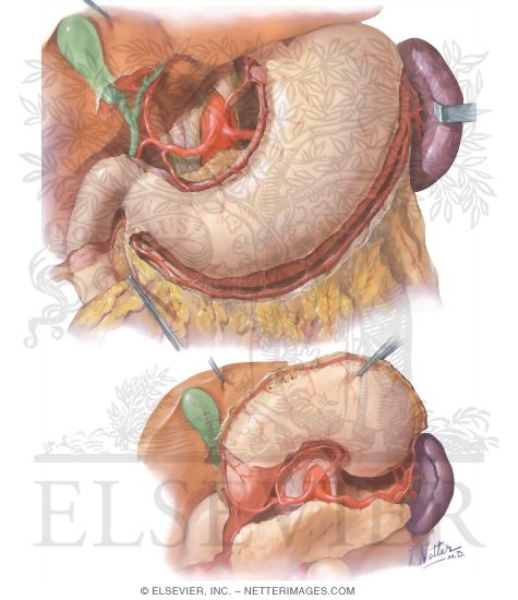 Watermarked preview of unlabeled image: Arterial Supply of Stomach