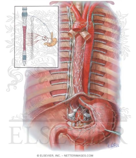 Nerve Supply of Stomach