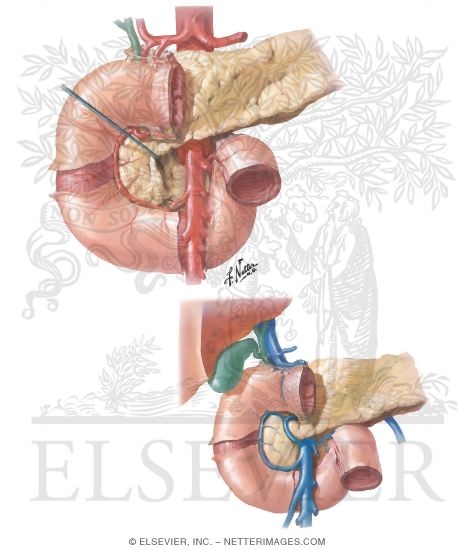 Blood Supply of Duodenum