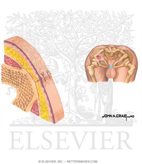 Watermarked preview of unlabeled image: Mehods of Wound Closure