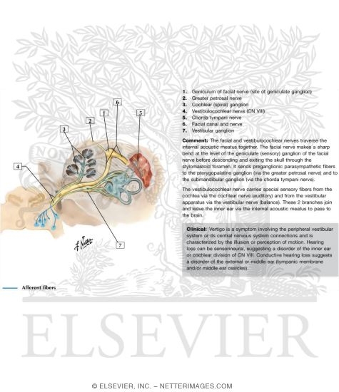 Vestibulocochlear Nerve (VIII)