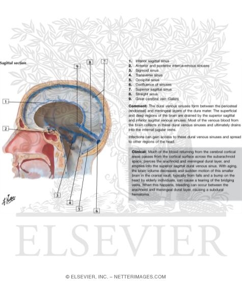 Dural Venous Sinuses