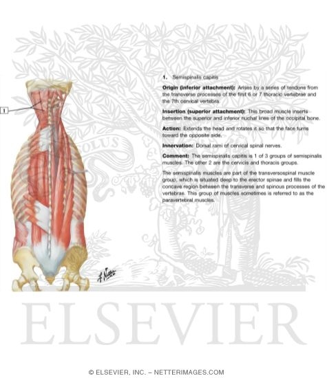 Watermarked preview of labeled image: Muscles of Back: Intermediate Layers
Spenius and Erector Spinae Muscles