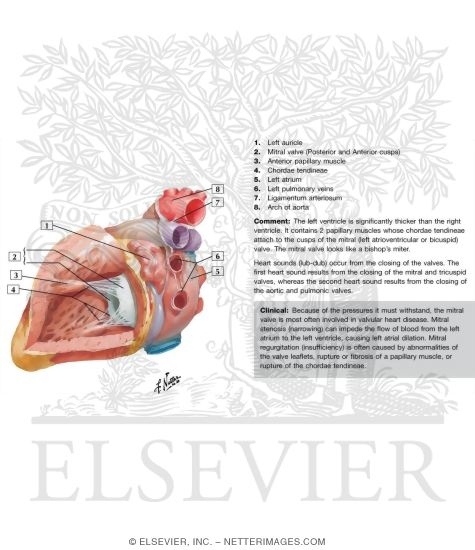 Watermarked preview of labeled image: Left Atrium and Left Ventricle