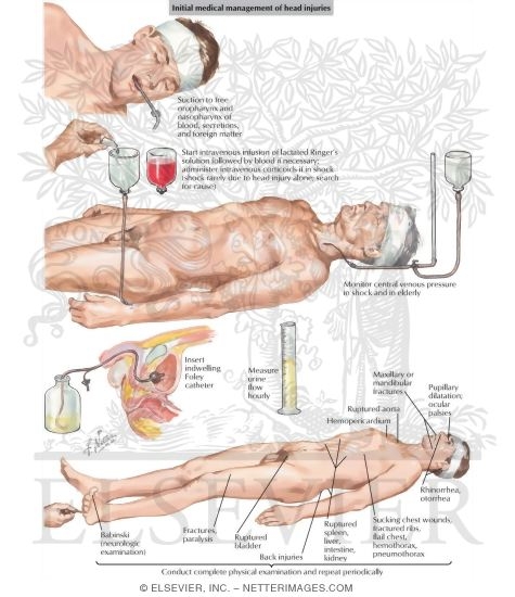 Watermarked preview of labeled image: Initial Medical Management of Head Injuries