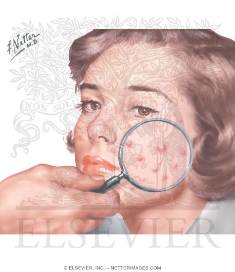 Watermarked preview of unlabeled image: Selected Dermatoses Seen in General Practice